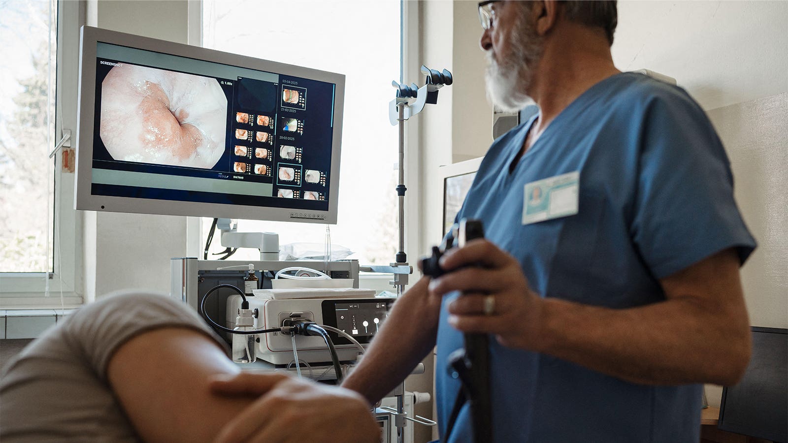 OCULUS trial randomizes patients to hold or continue their GLP-1 before endoscopy