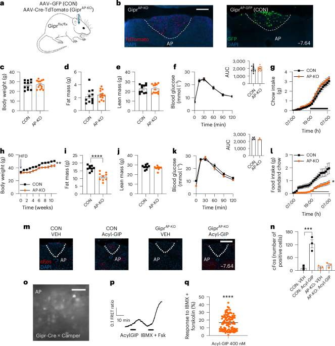 Two brain regions found to explain the GIP paradox