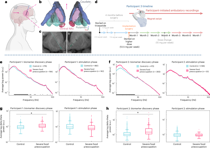 Brain recordings suggest tirzepatide's effect on food noise may be temporary
