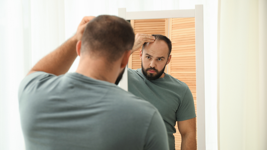 Penn's hair loss findings break into mainstream coverage, and its authors push back on the weight-loss explanation