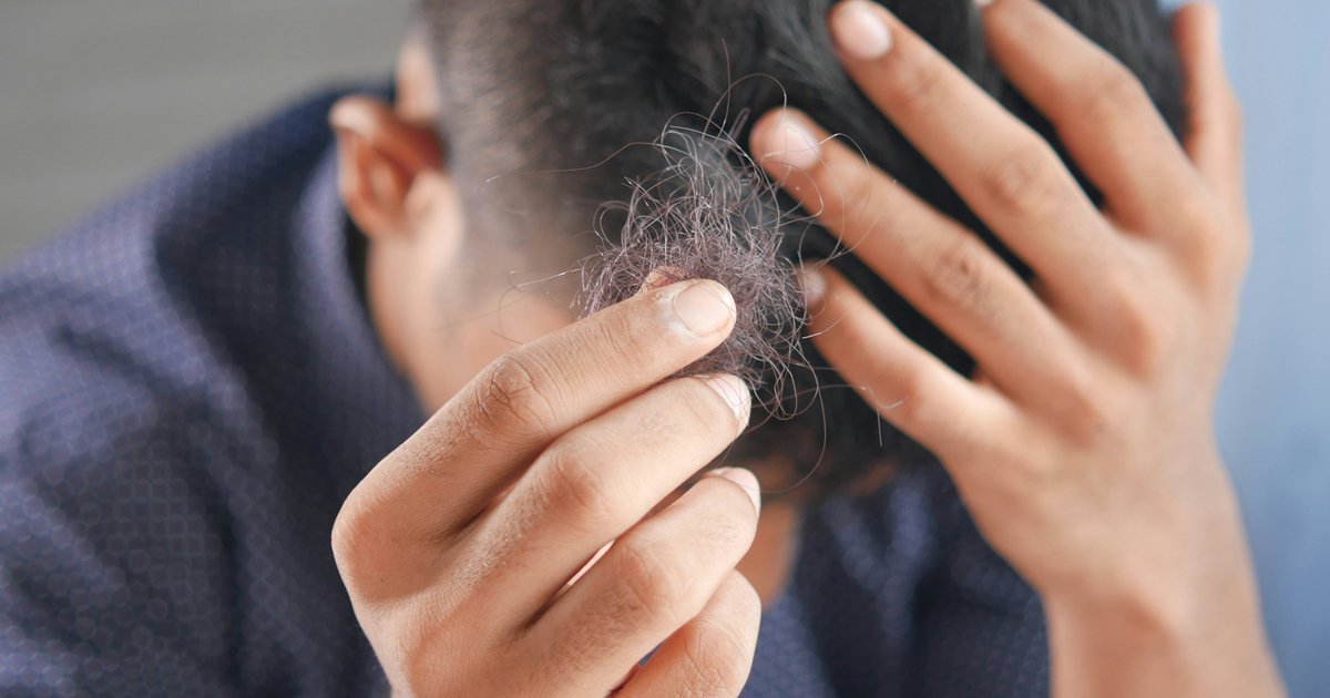 Penn's hair loss findings break into mainstream coverage, and its authors push back on the weight-loss explanation
